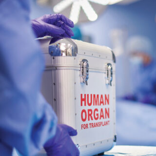 organ transplant